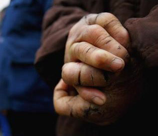 Lepers At A Village Leprosarium In China -- Photo credit, PicApp